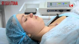 Russian video. Examination and treatment of labial papilloma. 4:38