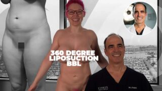 The Surprising Aftermath of This Popular Adult Entertainer’s Liposuction Surgery!