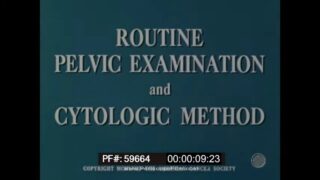 1958 MEDICAL TRAINING FILM ON ROUTINE PELVIC EXAMINATION CYTOLOGIC METHOD PAP TEST