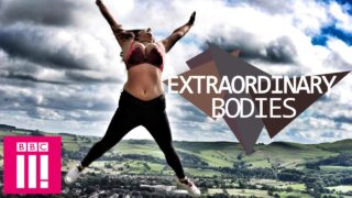 Double Mastectomy Twins | Extraordinary Bodies (18 mins in)