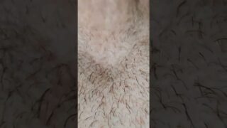 pubic hair